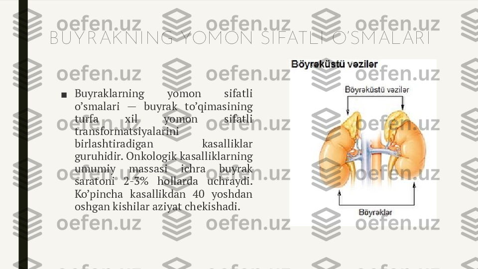 B U Y R AK NI NG YOM ON SI FATLI  O’SM ALAR I
■ Buyraklarning  yomon  sifatli 
o’smalari  —  buyrak  to’qimasining 
turfa  xil  yomon  sifatli 
transformatsiyalarini 
birlashtiradigan  kasalliklar 
guruhidir. Onkologik kasalliklarning 
umumiy  massasi  ichra  buyrak 
saratoni  2-3%  hollarda  uchraydi. 
Ko’pincha  kasallikdan  40  yoshdan 
oshgan kishilar aziyat chekishadi. 