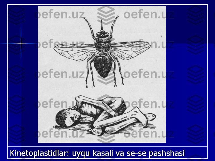 Kinetoplastidlar: uyqu kasali va se	-	se pashshasi 