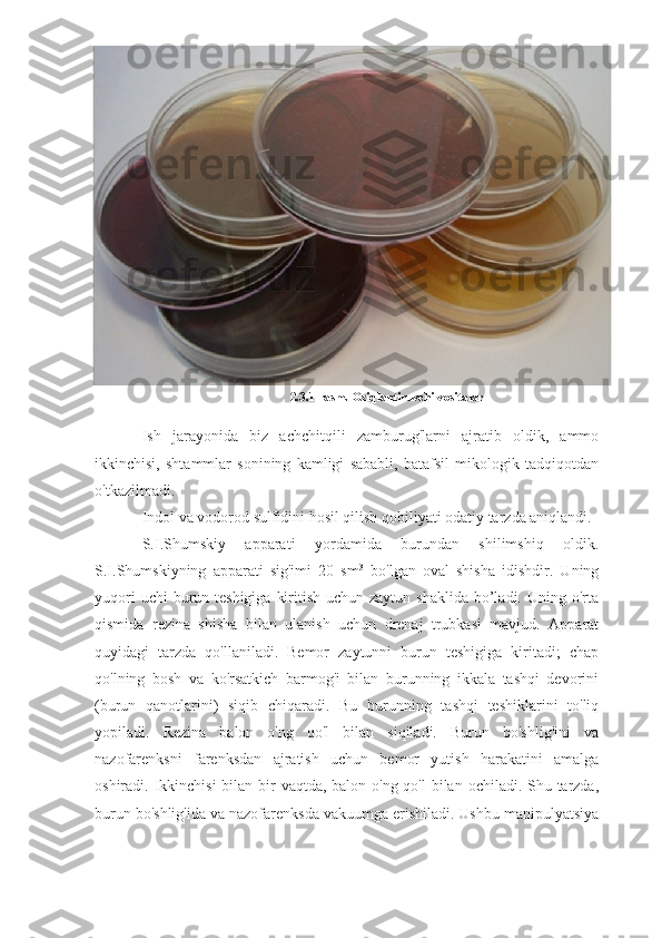 2.3.1-rasm. Oziqlantiruvchi vositalar
Ish   jarayonida   biz   achchitqili   zamburug'larni   ajratib   oldik,   ammo
ikkinchisi,   shtammlar   sonining   kamligi   sababli,   batafsil   mikologik   tadqiqotdan
o'tkazilmadi.
Indol va vodorod sulfidini hosil qilish qobiliyati odatiy tarzda aniqlandi.
S.I.Shumskiy   apparati   yordamida   burundan   shilimshiq   oldik.
S.I.Shumskiyning   apparati   sig'imi   20   sm 3
  bo'lgan   oval   shisha   idishdir.   Uning
yuqori  uchi  burun teshigiga  kiritish uchun zaytun  shaklida bo’ladi. Uning o'rta
qismida   rezina   shisha   bilan   ulanish   uchun   drenaj   trubkasi   mavjud.   Apparat
quyidagi   tarzda   qo'llaniladi.   Bemor   zaytunni   burun   teshigiga   kiritadi;   chap
qo'lning   bosh   va   ko'rsatkich   barmog'i   bilan   burunning   ikkala   tashqi   devorini
(burun   qanotlarini)   siqib   chiqaradi.   Bu   burunning   tashqi   teshiklarini   to'liq
yopiladi.   Rezina   balon   o'ng   qo'l   bilan   siqiladi.   Burun   bo'shlig'ini   va
nazofarenksni   farenksdan   ajratish   uchun   bemor   yutish   harakatini   amalga
oshiradi. Ikkinchisi  bilan bir vaqtda, balon o'ng qo'l  bilan ochiladi. Shu tarzda,
burun bo'shlig'ida va nazofarenksda vakuumga erishiladi. Ushbu manipulyatsiya 