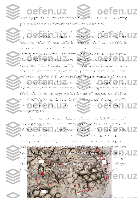 faqat   hujayralar   va   to'qimalarga   nisbatan   qo'llaniladi,   BS   maxsus   usullarning
yo'qligi sababli morfologik tadqiqotlar doirasidan tashqarida edi.
BSning   o'z-o'zini   tashkil   qilish   turlaridan   biri   suvsizlanish   paytida
suyuqlikdan   qattiq   fazaga   o'tishdir   [54].   Bir   qator   kasalliklarda   BS   ning   qattiq
fazasining   ma'lum   bir   vaqt   oralig'ida   fiksatsiyasi   ularni   turli   bosqichlarda
tashxislash   uchun   asos   bo'ldi   [66].   Burunning   shilliq   qavatlaridan   bir   tomchi
sekretsiyaning   suvsizlanishi   BSni   qattiq   fazaga   o'tkazish   va   quruq   plyonka
(fatsiya)   olish   imkonini   beradi.   Fatsiya   -   tekshirilayotgan   suyuqlikning   qattiq,
yupqa "kesimi"dir. Ushbu usul mualliflarining fikriga ko'ra, fasiya tuzilishi unda
mavjud   bo'lgan   barcha   murakkab   molekulyar   munosabatlar   haqida   integral
ma'lumotni   o'z   ichiga   oladi,   ular   makroskopik   darajada   maxsus   tarzda   tartibga
solinadi   va   o'zgartiriladi   [66].   Surunkali   atrofik   rinit   bilan   og'rigan   bemorlarni
tekshirishda   biz   tomonidan   degidrotasiya   usuli   bilan   olingan   morfotiplar   bo'lib
chiqdi.   Ular   normal   sekretsiya   morfotipidan   sezilarli   darajada   farq   qiladi   va
yiringli   yallig'lanish   davrida   burun   bo'shlig'i   va   paranasal   sinuslarning   shilliq
qavatida   yuzaga   keladigan   patologik   o'zgarishlarni   aks   ettiruvchi   o'ziga   xos
xususiyatlarga ega.  
Oraliq   va   o'tish   zonalari   faqat   7   nafar   bemorda   (5,83%   tadqiqotlar)
shakllangan   va   shuning   uchun   ularning   mavjudligi   SGR   uchun   atipik   deb
baholangan   va   batafsil   o'rganilmagan.   SGRdagi   periferik   zonaning   radial
yoriqlari   va  arkadalari   normal  burun  sekretsiyasi  arkadalariga  xos   bo'lgan  aniq
radial   yo'nalishini   yo'qotdi,   turli   burchaklarda   og'di   va   yumaloq   shaklga   yaqin
joylashishni oldi. Shu bilan birga, arkadalarning simmetriyasi (o'lchamlari, doira
sektorining to'g'riligi, kontur chizig'ining tekisligi) sezilarli darajada buzilgan va
ba'zi   arkadalar   qisqartirilgan   yoylar   shaklida   alohida   bo'laklarga   bo'lingan.
Periferik   zonadagi   yoriqlar   xaotik   tartibga   ega   bo'lib,   ko'pincha   kesishgan,
singan chiziqlarning tartibsiz to'planishi tasvirini hosil qilgan (3.3.1-rasm). 