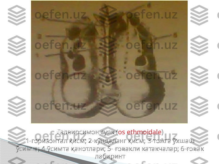 Ғалвирсимон суяк  ( os ethmoidale )
1- горизонтал қисм; 2-кўндаланг қисм; 3-тожга ўхшаш 
ўсимта; 4-ўсимта қанотлари; 5- ғовакли катакчалар; 6-ғовак 
лабиринт     