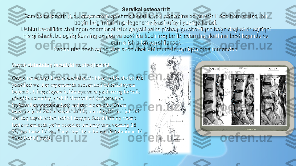 Servikal osteoartrit
Serviks osteoartriti, bu degenerativ qo'shma kasallik yoki oddiygina bo'yin artriti deb ham ataladi, bu 
bo'yin bo'g'imlarining degeneratsiyasi tufayli yuzaga keladi.
Ushbu kasallikka chalingan odamlar elkalariga yoki yelka pichog'iga cho'zilgan bo'ynidagi o'tkir og'riqni 
his qilishadi, bu og'riq kunning oxirida va boshida kuchliroq bo'lib, odam harakatlana boshlaganda va 
dam olish bilan yaxshilanadi.
Ba'zan ular bosh og'rig'idan azob chekishi mumkin, ayniqsa orqa tomondan.
Suyak tizimining tuzulishi va rivojlanishi.
Odam tanasidagi barcha suyaklar birikkan holda sk е l е t d е b 
yuritiladi va ular organizmda asosan uch xil funktsiyani 
bajaradi. Ularga tayanch, himoya va suyaklarning ko`mik 
qismida qonnning shaklli el е m е ntlari (eritrotsitlar, 
l е ykotsitlar, trombotsitlar) ishlab chiqariladi. Odam 
tanasida jami 206 ta suyak bo`lib, ularning 85 tasi juft 36 
tasi toq suyaklardan tashkil topgan. Suyaklarning vazni: 
katta odamlarda ya’ni erkaklar umumiy tana vazning 18 
%, ayollarda 17 % , Yangi tug`ilgan bolalarda tahminan 14 
% ni tashkil etadi.  