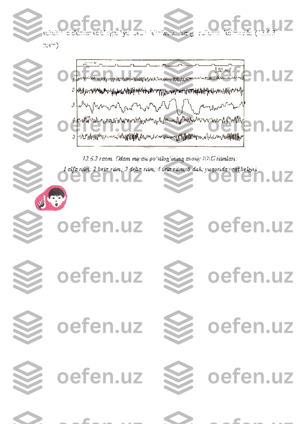 sababli   elektroensefalografiya   usuli   klinikada   keng   qullanib   kelmoqda   (13.6.3-
rasm)
13.6.3- racm .  Odam   miyasi   po ’ stlog ’ ining   asosiy   EEG   ritmlari :
1-alfa ritm; 2-beta-ritm; 3-delta-ritm; 4-teta-ritm; 5-duk; yuqorida vaqt belgisi 
