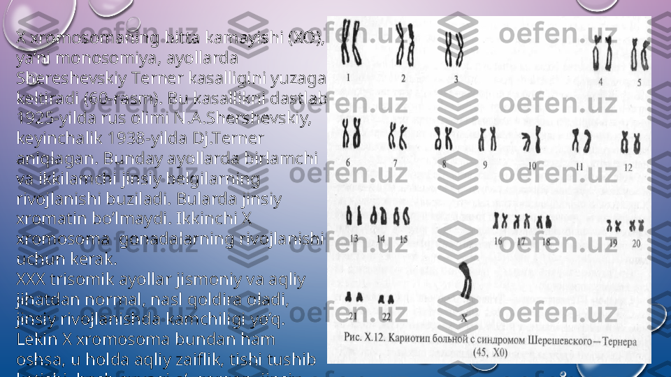 Х х r о m о s о maning bitta kamayishi ( ХО), 
ya’ni m о n о s о miya, ayollarda 
Sh е r е sh е vskiy T е rn е r kasalligini yuzaga 
k е ltiradi (60-r а sm). Bu kasallikni dastlab 
1925-yilda rus  о limi N.A.Sh е rsh е vskiy, 
k е yinchalik 1938-yilda Dj.T е rn е r 
aniqlagan. Bunday ayollarda birlamchi 
va ikkilamchi jinsiy b е lgilarning 
riv о jlanishi buziladi. Bularda jinsiy 
х r о matin bo’lmaydi. Ikkinchi  Х 
х r о m о s о ma  g о nadalarning riv о jlanishi 
uchun k е rak. 
ХХХ  tris о mik ayollar jism о niy va aqliy 
jihatdan n о rmal, nasl q о ldira  о ladi, 
jinsiy riv о jlanishda kamchiligi yo’q. 
L е kin  Х х r о m о s о ma bundan ham 
о shsa, u h о lda aqliy zaiflik, tishi tushib 
k е tishi, b о sh suyagi o’zgargan, jinsiy 
о rganlarida o’zgarish yuzaga k е ladi.   