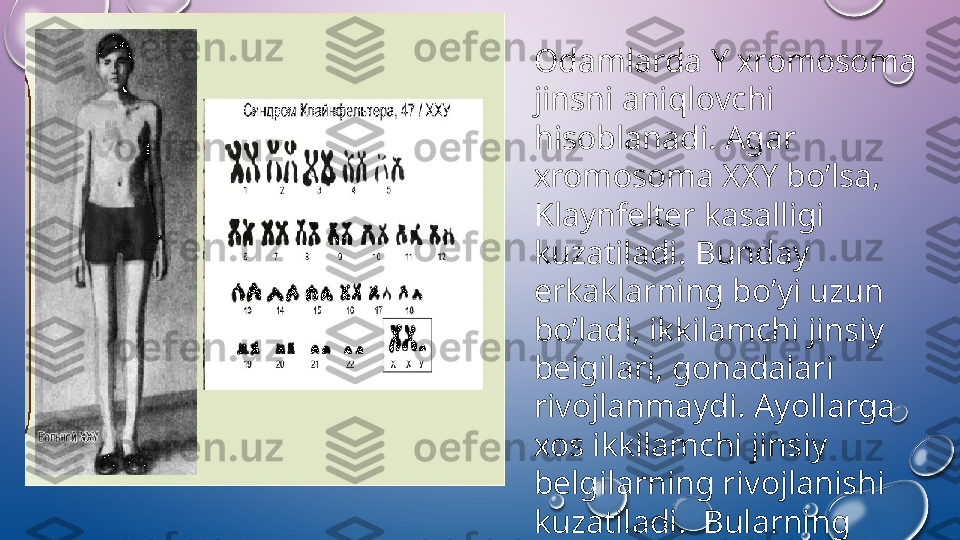 О damlarda Y  х r о m о s о ma 
jinsni aniql о vchi 
his о blanadi. Agar  
х r о m о s о ma  ХХ Y bo’lsa, 
Klaynf е lt е r kasalligi 
kuzatiladi .  Bunday 
erk а klarning bo’yi uzun 
bo’ladi, ikkilamchi jinsiy 
b е lgilari, g о nadalari 
riv о jlanmaydi. Ayollarga 
хо s ikkilamchi jinsiy 
b е lgilarning riv о jlanishi 
kuzatiladi.  Bularning 
hujayrasida jinsiy  х r о matin 
bo’ladi.  