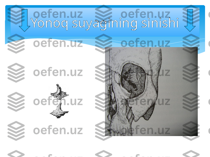 Yonoq suyagining sinishi   