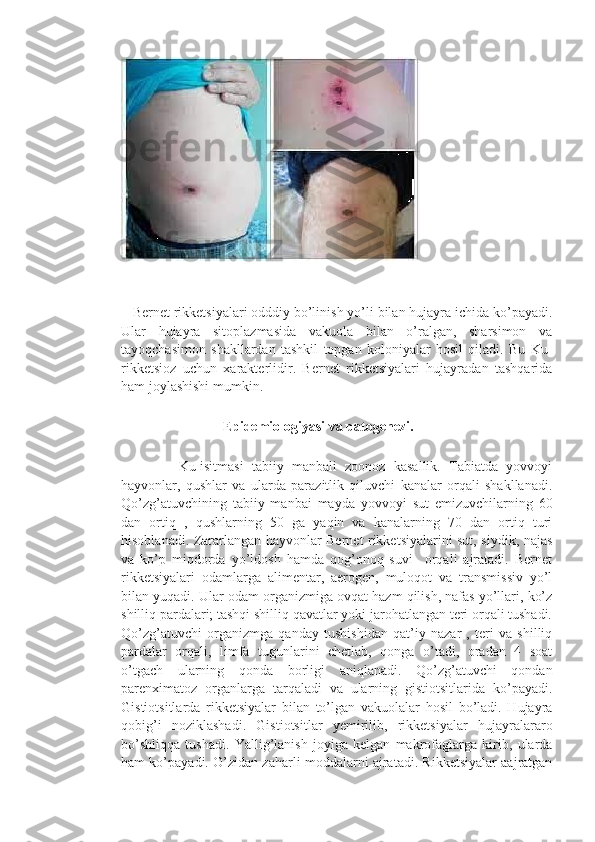    Bernet rikketsiyalari odddiy bo’linish yo’li bilan hujayra ichida ko’payadi.
Ular   hujayra   sitoplazmasida   vakuola   bilan   o’ralgan,   sharsimon   va
tayoqchasimon   shakllardan   tashkil   topgan   koloniyalar   hosil   qiladi.   Bu   Ku-
rikketsioz   uchun   xarakterlidir.   Bernet   rikketsiyalari   hujayradan   tashqarida
ham joylashishi mumkin.
                             Epidemiologiyasi va patogenezi. 
              Ku-isitmasi   tabiiy   manbali   zoonoz   kasallik.   Tabiatda   yovvoyi
hayvonlar,   qushlar   va   ularda   parazitlik   qiluvchi   kanalar   orqali   shakllanadi.
Qo’zg’atuvchining   tabiiy   manbai   mayda   yovvoyi   sut   emizuvchilarning   60
dan   ortiq   ,   qushlarning   50   ga   yaqin   va   kanalarning   70   dan   ortiq   turi
hisoblanadi. Zararlangan hayvonlar Bernet rikketsiyalarini sut, siydik, najas
va   ko’p   miqdorda   yo’ldosh   hamda   qog’onoq   suvi     orqali   ajratadi.   Bernet
rikketsiyalari   odamlarga   alimentar,   aerogen,   muloqot   va   transmissiv   yo’l
bilan yuqadi. Ular odam organizmiga ovqat hazm qilish, nafas yo’llari, ko’z
shilliq pardalari; tashqi shilliq qavatlar yoki jarohatlangan teri orqali tushadi.
Qo’zg’atuvchi   organizmga   qanday   tushishidan   qat’iy   nazar   ,   teri   va   shilliq
pardalar   orqali,   limfa   tugunlarini   chetlab,   qonga   o’tadi,   oradan   4   soat
o’tgach   ularning   qonda   borligi   aniqlanadi.   Qo’zg’atuvchi   qondan
parenximatoz   organlarga   tarqaladi   va   ularning   gistiotsitlarida   ko’payadi.
Gistiotsitlarda   rikketsiyalar   bilan   to’lgan   vakuolalar   hosil   bo’ladi.   Hujayra
qobig’i   noziklashadi.   Gistiotsitlar   yemirilib,   rikketsiyalar   hujayralararo
bo’shliqqa   tushadi.   Yallig’lanish   joyiga   kelgan   makrofaglarga   kirib,   ularda
ham ko’payadi. O’zidan zaharli moddalarni ajratadi. Rikketsiyalar aajratgan 