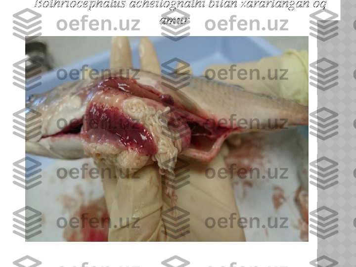 Bothriocephalus acheilognathi bilan zararlangan oq 
amur  