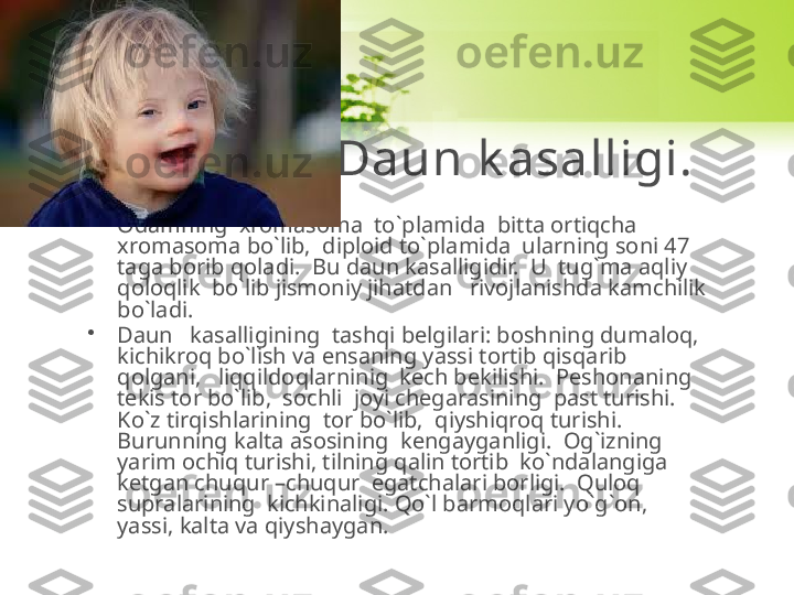 Daun k asalligi. 
•
Odamning  xromasoma  to`plamida  bitta ortiqcha 
xromasoma bo`lib,  diploid to`plamida  ularning soni 47 
taga borib qoladi.  Bu daun kasalligidir.  U  tug`ma aqliy 
qoloqlik  bo`lib jismoniy jihatdan   rivojlanishda kamchilik 
bo`ladi. 
•
Daun   kasalligining  tashqi belgilari: boshning dumaloq,  
kichikroq bo`lish va ensaning yassi tortib qisqarib 
qolgani,   liqqildoqlarninig  kech bekilishi.  Peshonaning  
tekis tor bo`lib,  sochli  joyi chegarasining  past turishi.  
Ko`z tirqishlarining  tor bo`lib,  qiyshiqroq turishi.  
Burunning kalta asosining  kengayganligi.  Og`izning 
yarim ochiq turishi, tilning qalin tortib  ko`ndalangiga 
ketgan chuqur –chuqur  egatchalari borligi.  Quloq 
supralarining  kichkinaligi. Qo`l barmoqlari yo`g`on, 
yassi, kalta va qiyshaygan. 