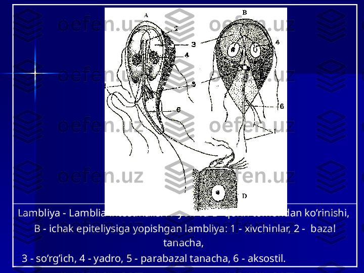 Lambliya  - Lamblia intestinalis: A- yon va B- qorin tomondan ko’rinishi, 
B - ichak epiteliysiga yopishgan lambliya: 1 - xivchinlar, 2 -  bazal 
tanacha, 
   3 - so’rg’ich, 4 - yadro, 5 - parabazal tanacha, 6 - aksostil.  