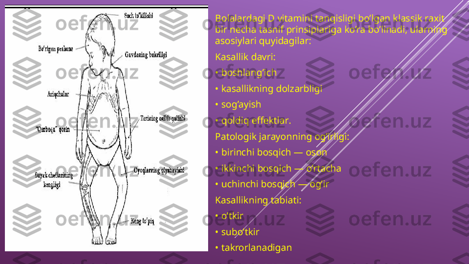 Bolalardagi D vitamini tanqisligi bo’lgan klassik raxit 
bir necha tasnif prinsiplariga ko’ra bo’linadi, ularning 
asosiylari quyidagilar :
Kasallik davri :
•  boshlang’ich
•  kasallikning dolzarbligi
•  sog’ayish
•  qoldiq effektlar .
Patologik jarayonning og’irligi:
•  birinchi bosqich — oson
•  ikkinchi bosqich — o’rtacha
•  uchinchi bosqich — og’ir
Kasallikning tabiati:
•  o’tkir
•  subo’tkir
•  takrorlanadigan 