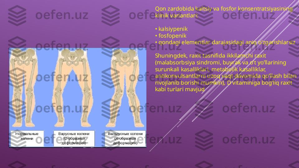 Qon zardobida kaltsiy va fosfor konsentratsiyasining 
klinik variantlari:
•  kalsiypenik
•  fosfopenik
•  qondagi elementlar darajasidagi aniq o’zgarishlarsiz
Shuningdek, raxit tasnifida ikkilamchi raxit 
(malabsorbsiya sindromi, buyrak va o’t yo’llarining 
surunkali kasalliklari, metabolik kasalliklar, 
antikonvulsantlarni uzoq vaqt davomida qo’llash bilan 
rivojlanib borishi mumkin), D vitaminiga bog’liq raxit 
kabi turlari mavjud 