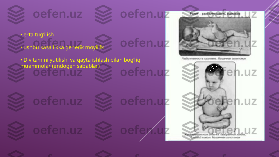 •  erta tug’ilish 
•  ushbu kasallikka genetik moyillik
•  D vitamini yutilishi va qayta ishlash bilan bog’liq 
muammolar (endogen sabablar) 