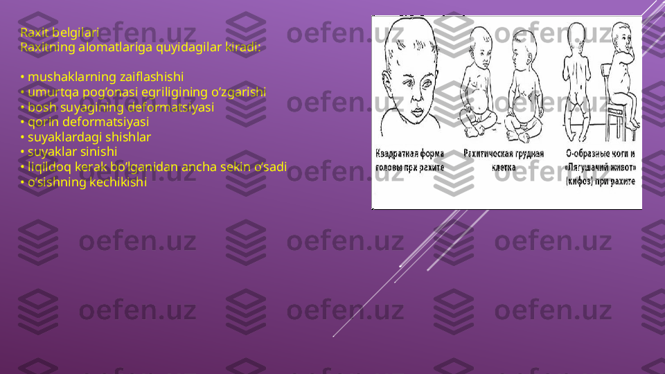 Raxit belgilari
Raxitning alomatlariga quyidagilar kiradi:
•  mushaklarning zaiflashishi
•  umurtqa pog’onasi egriligining o’zgarishi
•  bosh suyagining deformatsiyasi
•  qorin deformatsiyasi
•  suyaklardagi shishlar
•  suyaklar sinishi
•  liqildoq kerak bo’lganidan ancha sekin o’sadi
•  o’sishning kechikishi 