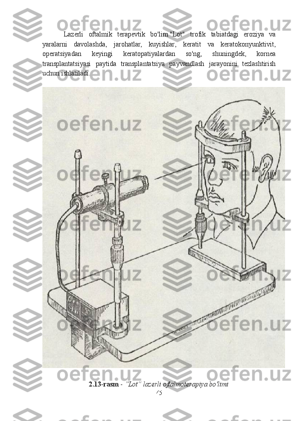 Lazerli   oftalmik   terapevtik   bo'lim   "Lot"   trofik   tabiatdagi   eroziya   va
yaralarni   davolashda,   jarohatlar,   kuyishlar,   keratit   va   keratokonyunktivit,
operatsiyadan   keyingi   keratopatiyalardan   so'ng,   shuningdek,   kornea
transplantatsiyasi   paytida   transplantatsiya   payvandlash   jarayonini   tezlashtirish
uchun ishlatiladi.
2.13-rasm  -  “Lot” lazerli oftalmoterapiya bo'limi
45 
