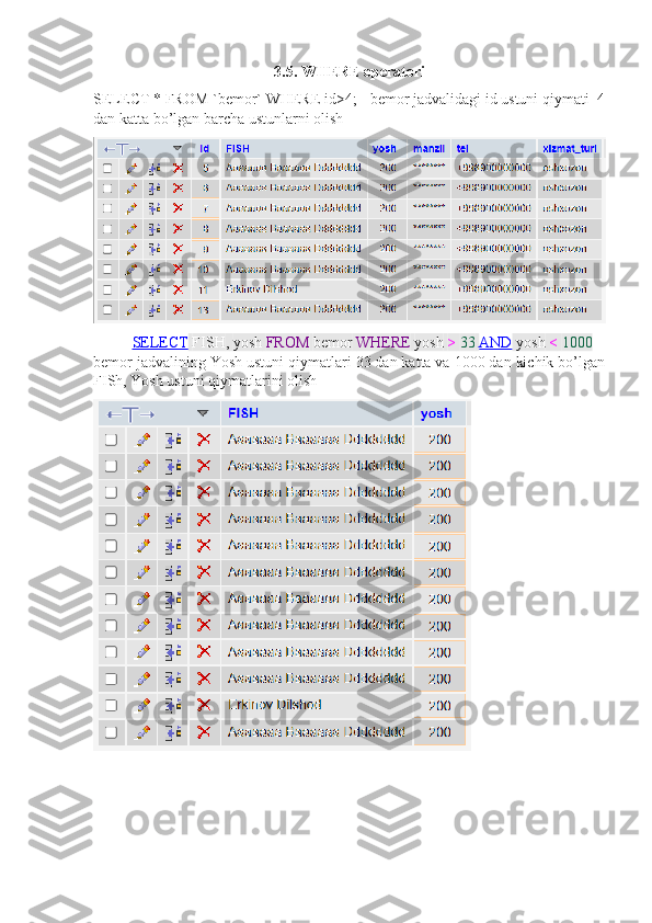 3.5. WHERE operatori
SELECT * FROM `bemor` WHERE id>4; - bemor jadvalidagi id ustuni qiymati  4
dan katta bo’lgan barcha ustunlarni olish
SELECT   FISH ,   yosh   FROM   bemor   WHERE   yosh   >   33   AND   yosh   <   1000
bemor jadvalining Yosh ustuni qiymatlari 33 dan katta va 1000 dan kichik bo’lgan
FISh, Yosh ustuni qiymatlarini olish 