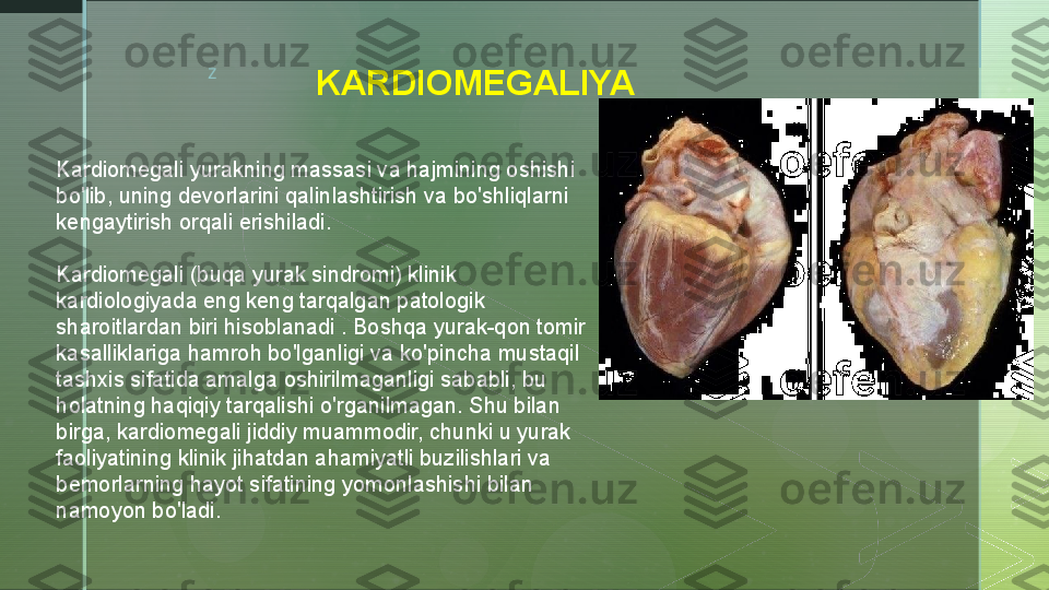 z
KARDIOMEGALIYA
Kardiomegali yurakning massasi va hajmining oshishi 
bo'lib, uning devorlarini qalinlashtirish va bo'shliqlarni 
kengaytirish orqali erishiladi.
Kardiomegali (buqa yurak sindromi) klinik 
kardiologiyada eng keng tarqalgan patologik 
sharoitlardan biri hisoblanadi . Boshqa yurak-qon tomir 
kasalliklariga hamroh bo'lganligi va ko'pincha mustaqil 
tashxis sifatida amalga oshirilmaganligi sababli, bu 
holatning haqiqiy tarqalishi o'rganilmagan. Shu bilan 
birga, kardiomegali jiddiy muammodir, chunki u yurak 
faoliyatining klinik jihatdan ahamiyatli buzilishlari va 
bemorlarning hayot sifatining yomonlashishi bilan 
namoyon bo'ladi.  