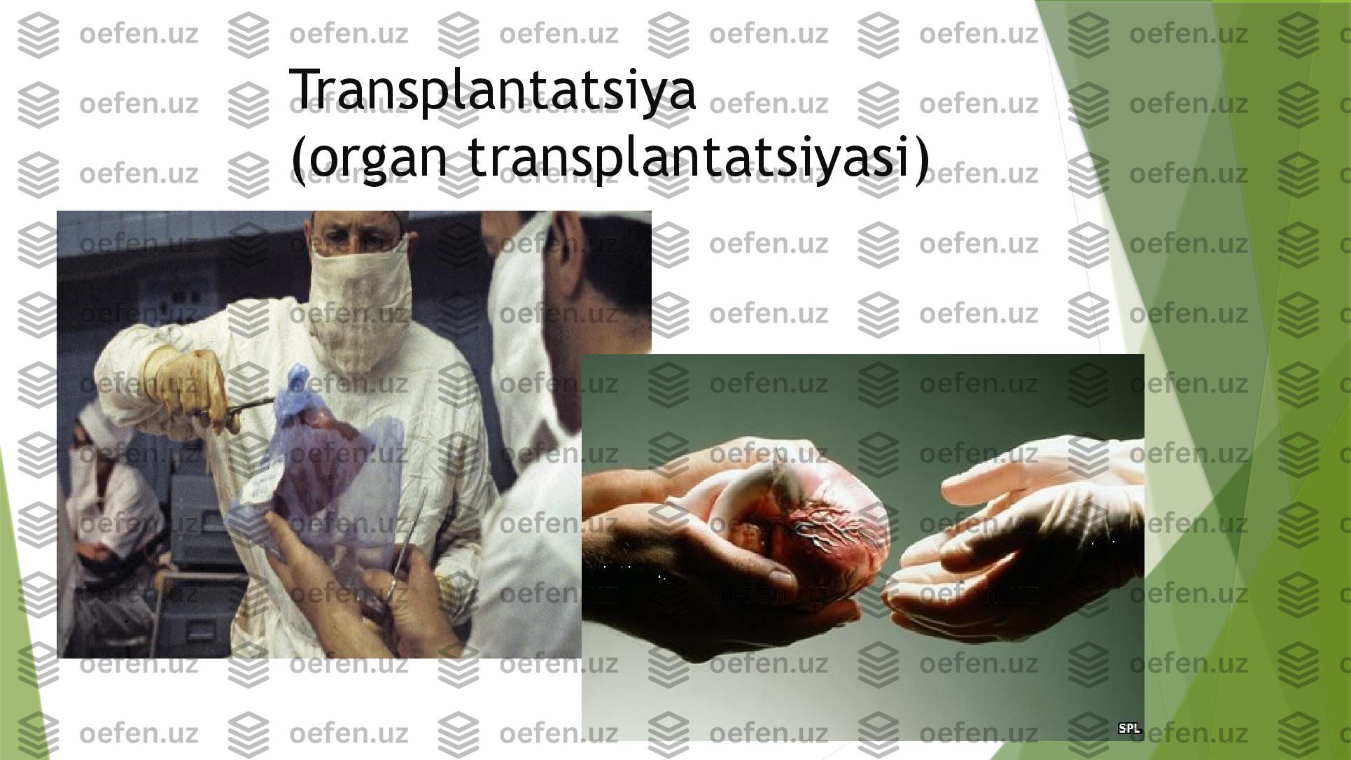 Transplantatsiya
( organ transplantatsiyasi)                 