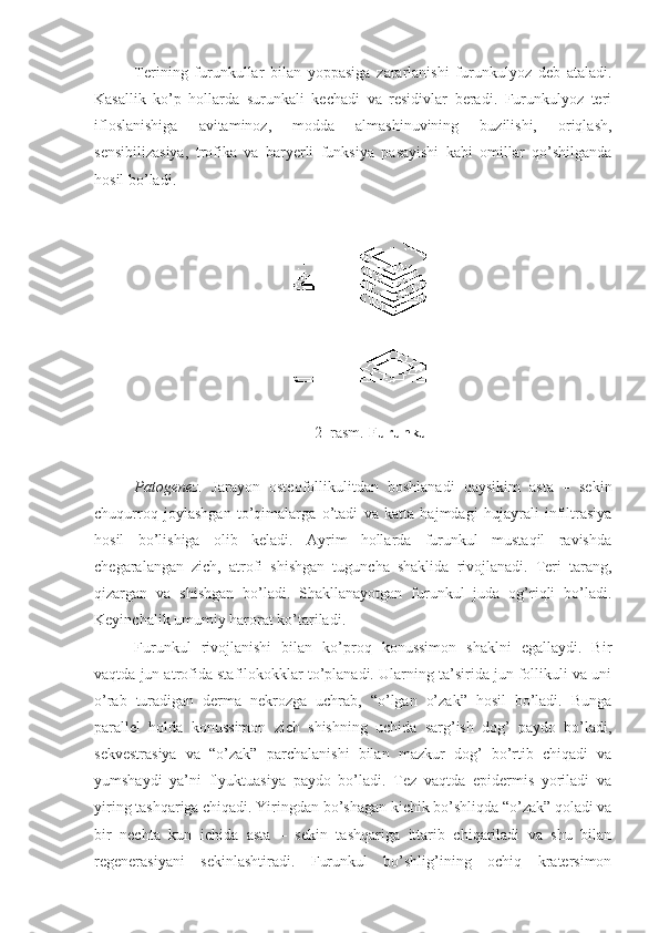 Terining   furunkullar   bilan   yoppasiga   zararlanishi   furunkulyoz   deb   ataladi.
Kasallik   ko’p   hollarda   surunkali   kechadi   va   residivlar   beradi.   Furunkulyoz   teri
ifloslanishiga   avitaminoz,   modda   almashinuvining   buzilishi,   oriqlash,
sensibilizasiya,   trofika   va   baryerli   funksiya   pasayishi   kabi   omillar   qo’shilganda
hosil bo’ladi.
2–rasm.  Furunkul
Patogenez.   Jarayon   osteo follikulitdan   boshlanadi   qaysikim   asta   –   sekin
chuqurroq   joylashgan   to’qimalarga   o’tadi   va   katta   hajmdagi   hujayrali   infiltrasiya
hosil   bo’lishiga   olib   keladi.   Ayrim   hollarda   furunkul   mustaqil   ravishda
chegaralangan   zich,   atrofi   shishgan   tuguncha   shaklida   rivojlanadi.   Teri   tarang,
qizargan   va   shishgan   bo’ladi.   Shakllanayotgan   furunkul   juda   og’riqli   bo’ladi.
Keyinchalik umumiy harorat ko’tariladi. 
Furunkul   rivojlanishi   bilan   ko’proq   konussimon   shaklni   egallaydi.   Bir
vaqtda jun atrofida stafilokokklar to’planadi. Ularning ta’sirida jun follikuli va uni
o’rab   turadigan   derma   nekrozga   uchrab,   “o’lgan   o’zak”   hosil   bo’ladi.   Bunga
parallel   holda   konussimon   zich   shishning   uchida   sarg’ish   dog’   paydo   bo’ladi,
sekvestrasiya   va   “o’zak”   parchalanishi   bilan   mazkur   dog’   bo’rtib   chiqadi   va
yumshaydi   ya’ni   flyuktuasiya   paydo   bo’ladi.   Tez   vaqtda   epidermis   yoriladi   va
yiring tashqariga chiqadi. Yiringdan bo’shagan kichik bo’shliqda “o’zak” qoladi va
bir   nechta   kun   ichida   asta   –   sekin   tashqariga   ittarib   chiqariladi   va   shu   bilan
regenerasiyani   sekinlashtiradi.   Furunkul   bo’shlig’ining   ochiq   kratersimon 