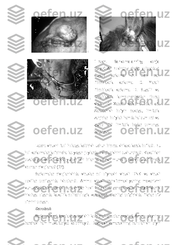 B  D
 E 1 –r asm.   Sarkomalarning   kenja
tiplari   A.   Boshning   chaka   so h asidagi
sugalli   sarko ma .   B.   Teri   osti
fibroblastik   sarko ma .   C.   Yarali
fibroblastik   sarko ma .   D.   Sugalli   va
fibroblastik   komponentlardan   iborat
shakl.   E.   Xatarli   sarko ma   bilan   ot.
Zararlanish   b o’ yin   pastiga,   limfatik
zanjirlar    bo’ylab   hamda halqum orti va
quloq   oldi   limfatik   bezlar   tomonga
tarqalgan. 
Latent virusni faol holatga keltirish uchun birorta shikast  kerak bo’ladi. Bu
hol   sarkomalar   ko’pincha lat yegan joylarda rivojlanishini tushuntiradi. Kasallikni
tozalangan   virusli   DNK   yuborilishi   bilan   chaqirish   mumkin,   ammo   u   ko’pincha
spontan rivojlanadi (23). 
Sarkomalar   rivojlanishida   viruslar   rol   o’ynashi   virusli   DNK   va   virusli
oqsillar   topilganida   isbotlandi.   Ammo   virusli   transformasi - yaning   mexanizmi
xunuzgacha   aniq   emas.   Sarkomalar   hosil   bo’lishida   genetik   va   zot   moyilliklarini
hisobga   olganda   kasallik   polietiologik   xarakterga   ekanligi   to’g’risida   fikrlar   o’z
o’rnini topgan.
Davolash
Sarkomalar ni davolashga tegishli ko’p ma’lumotlar mavjud. Ammo ularning
barchasi   ham   muvafaqiyat   keltirmaydi.   Davolash   samarasining   baholanishi   qiyin 